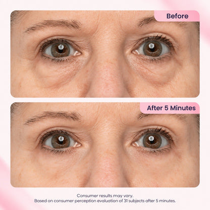 Instant Eye Revival